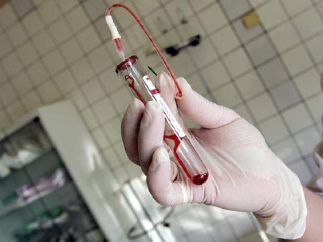 Realitate cutremurătoare: bolnavii de hepatită abia pot fi depistaţi în România